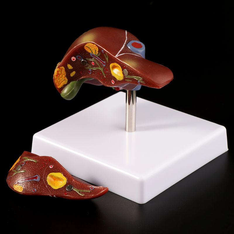 Medical Lab Design - Human Liver Pathological Anatomical Model Anatomy