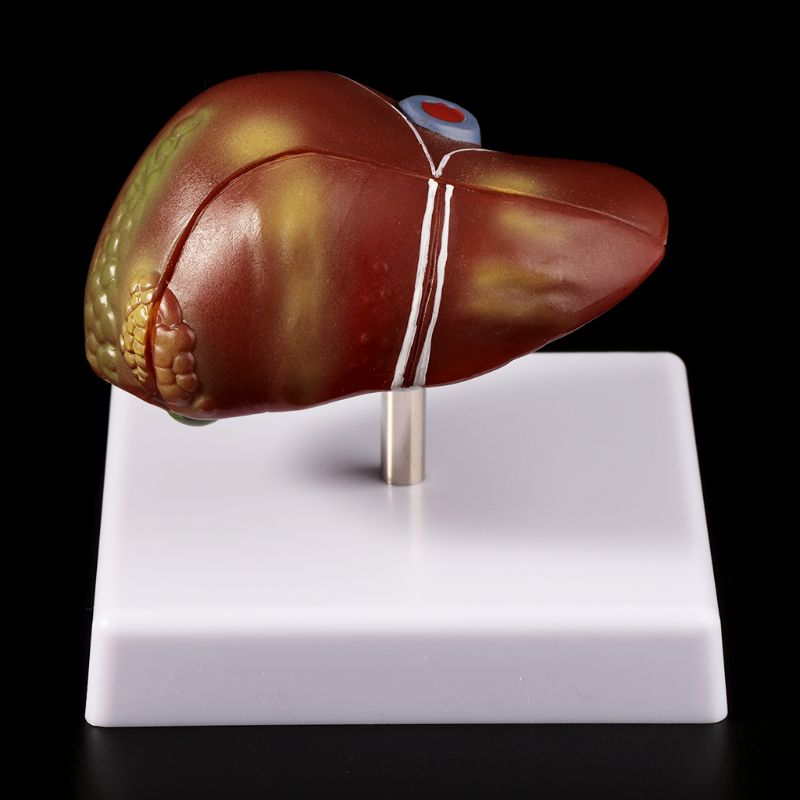 Human Liver Pathological Anato - Medical Lab Design review and price