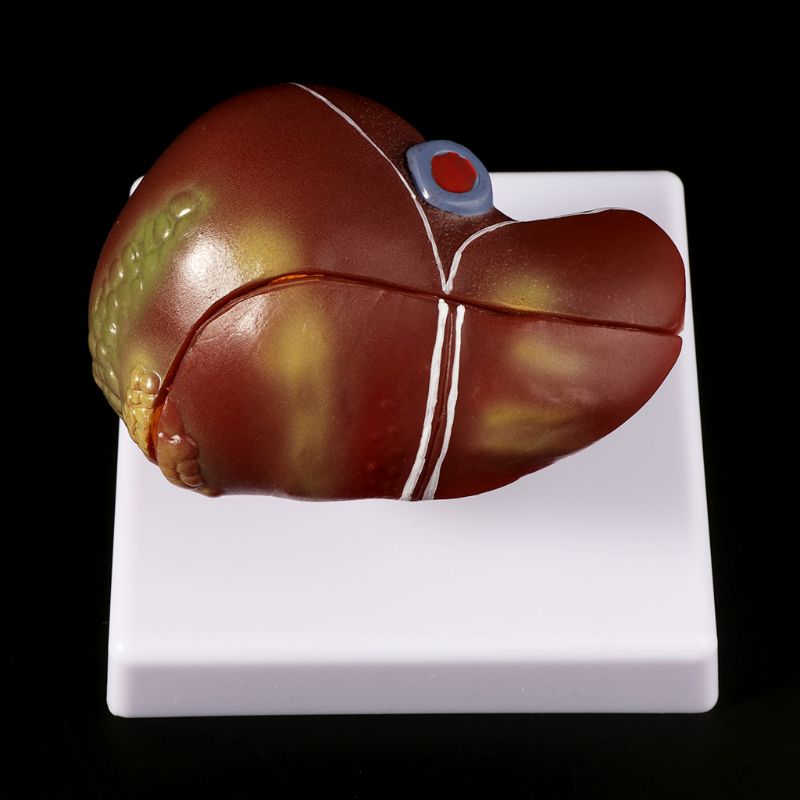 Human Liver Pathological Anato - Medical Lab Design review and price